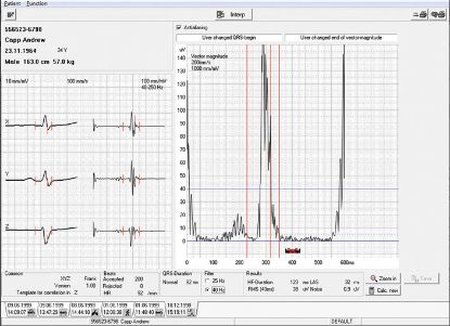 Sema Light Data Management Software (Schiller)