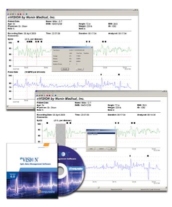 N-Vision Software (INC Download Cable)