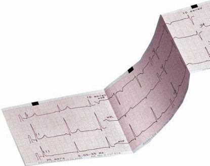 Ecg Paper Z-Fold A4 (Ct8000p) 9690029200