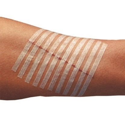 Steristirps Skin closure Strips (3M)