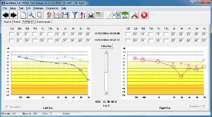 Audiometer Audiometric Audibase Pc Database