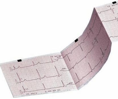 Ecg Paper Z-Fold Schiller M5-2010 Thermosensitive