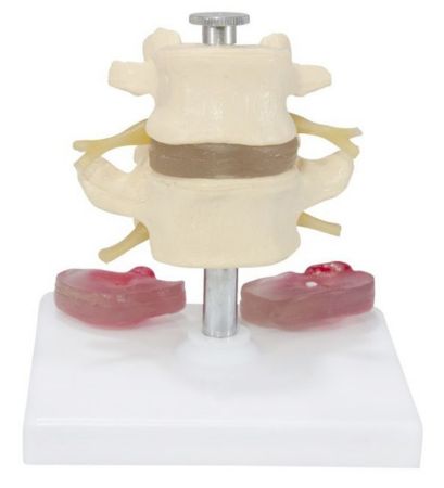 Picture for category Lumber Vertebrae Models