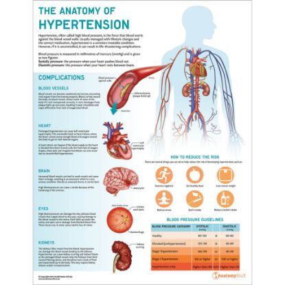 Anatomical Hypertension Understanding Chart 50 x 65cm