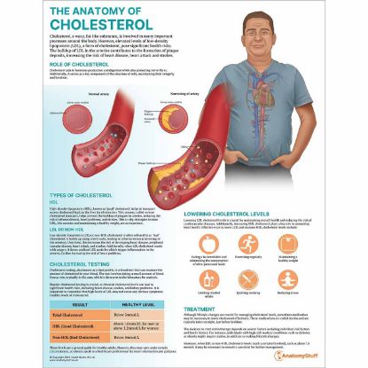 Anatomical Cholesterol Chart 45 x 60cm